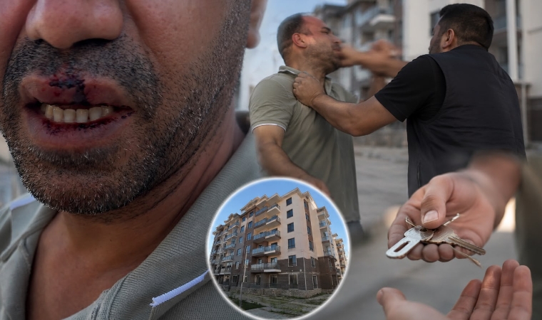 Anahtar Teslimi Sonrası ‘Para İstendi’ İddiası Hastanede Bitti