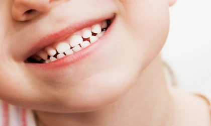 Çocuklarda diş çürüğü neden olur? Nelere dikkat edilmeli?